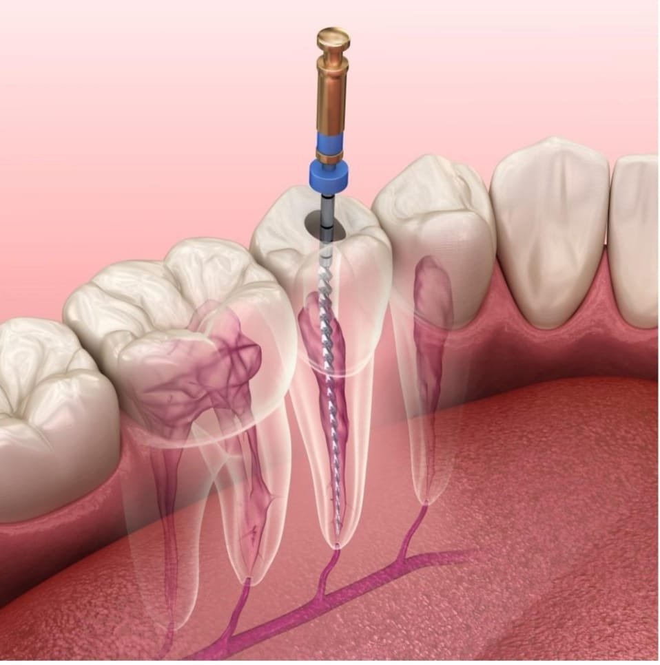 92f93721 6da6 4051 B154 87d96cfc8f3d